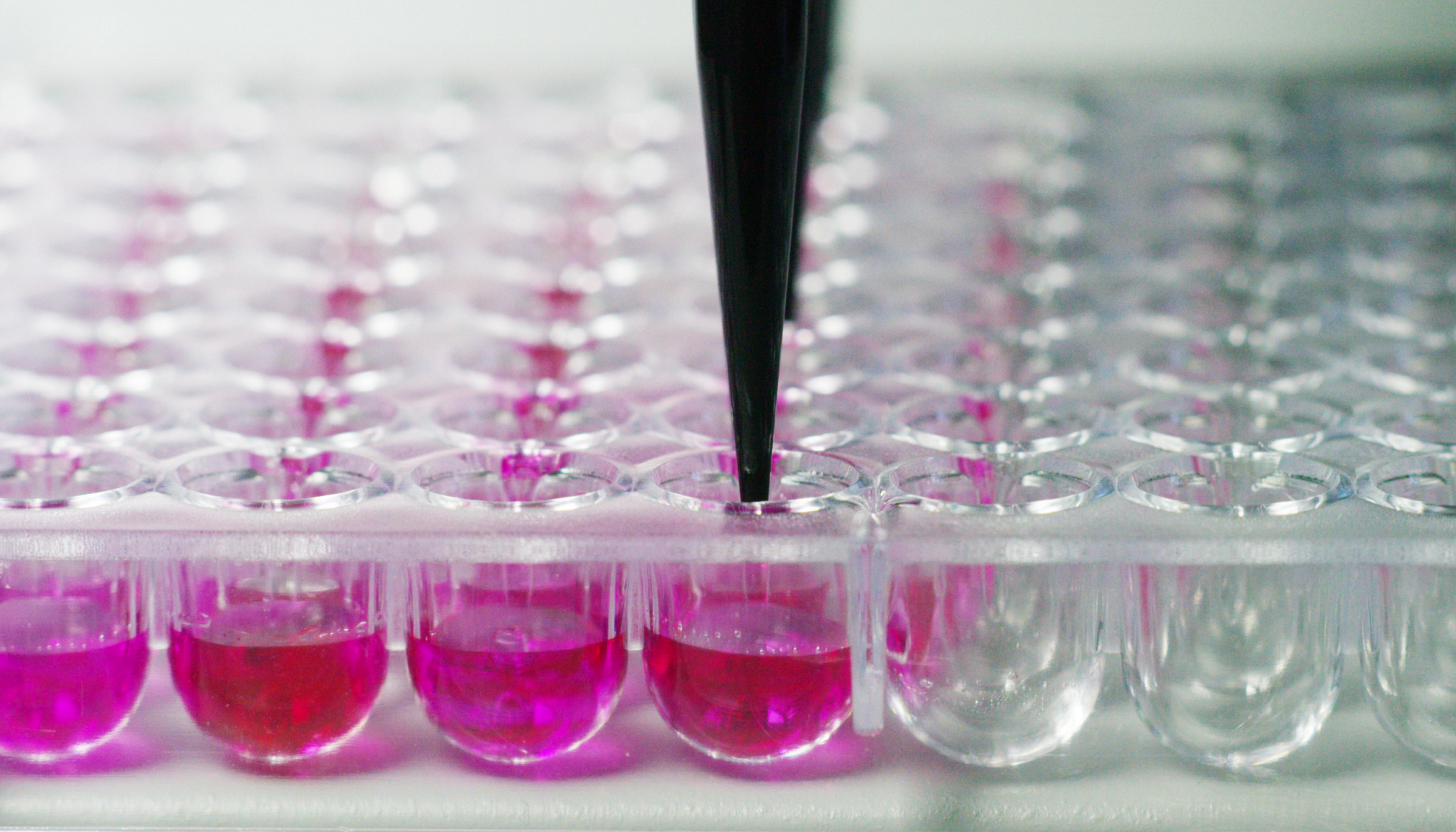 福氏志賀氏菌“靛基質試驗”的結果討論